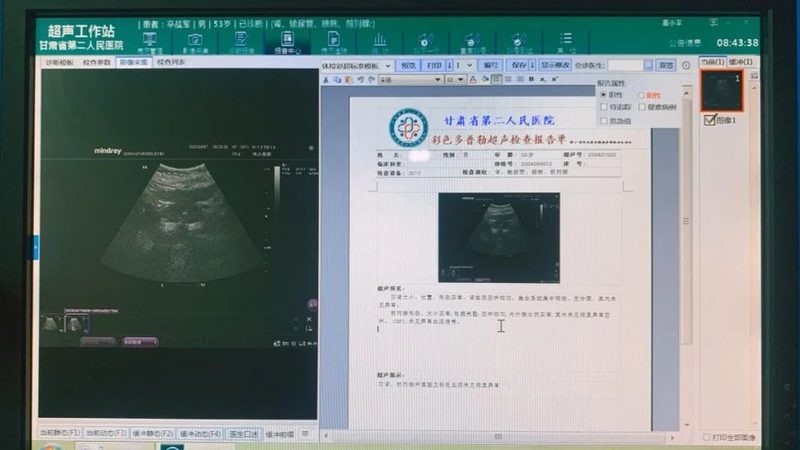 解码全基因组测序：揭秘个人基因密码的价格之谜**